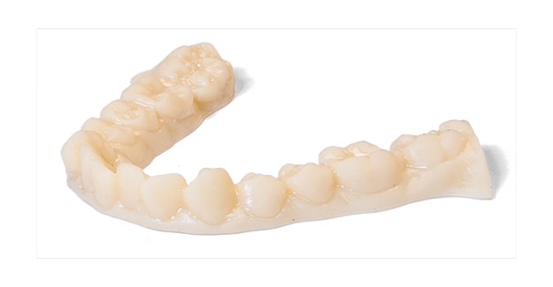 Models for clear aligner movement appliances