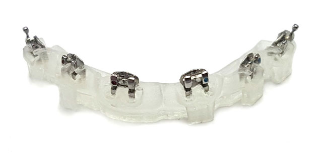 Indirect bonding transfer trays